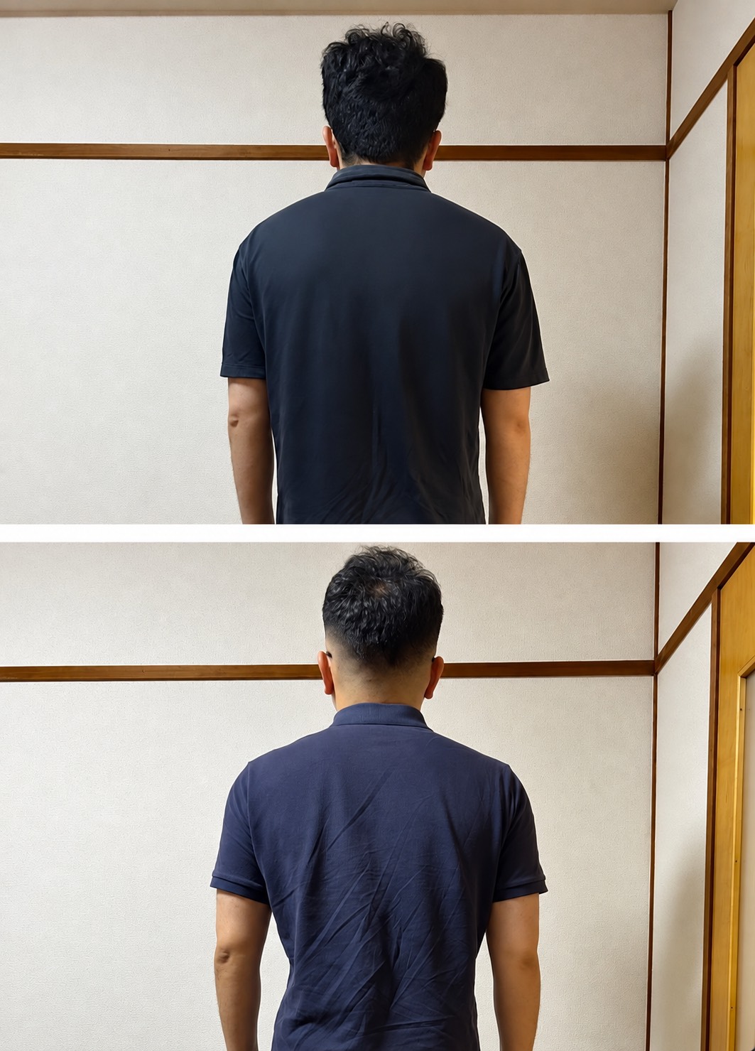 40代男性の後ろ姿の記録。上が施術1回目、下が施術3回目