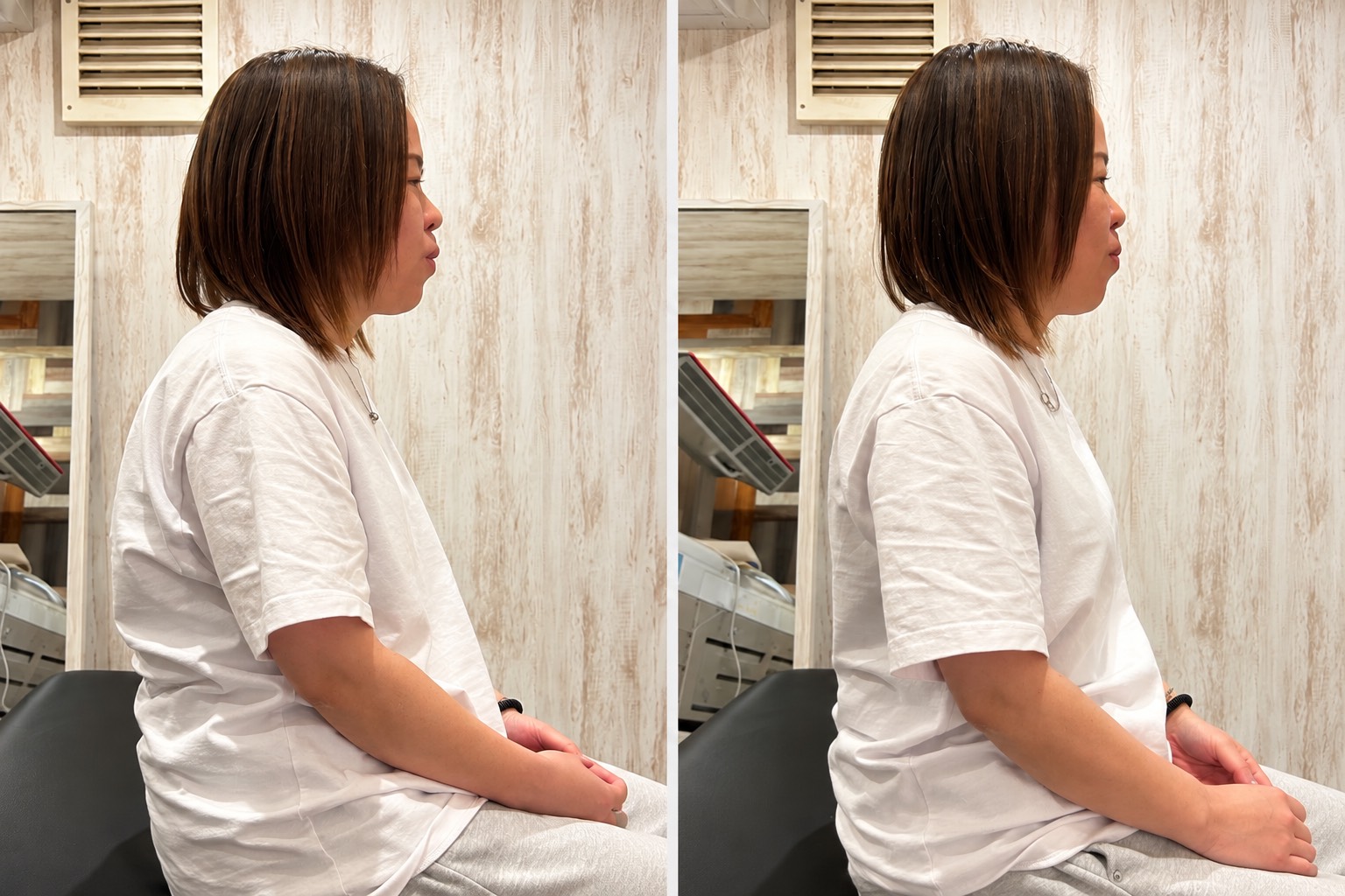 50代女性の座位姿勢の記録。左がケア前、右が1回のケア後