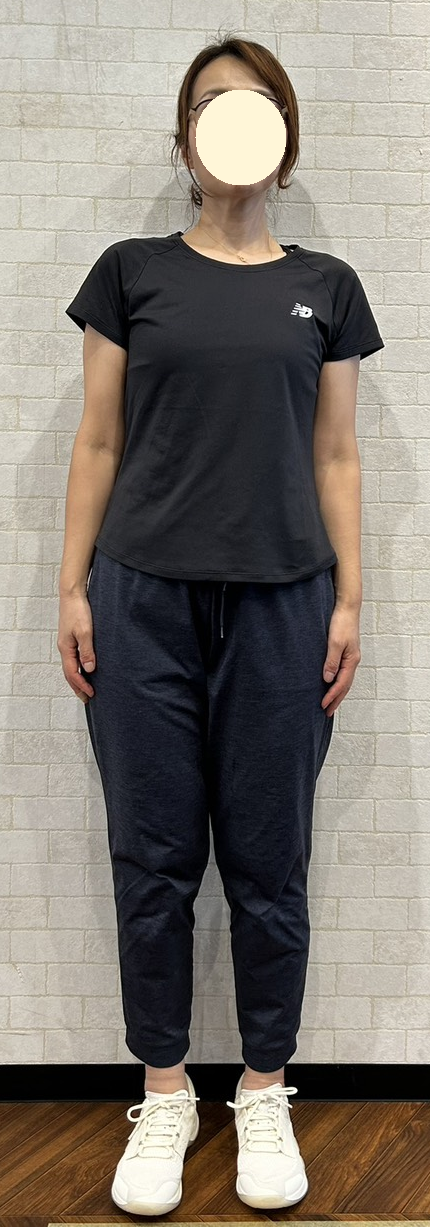40代女性の2026年のAfter写真(顔を保護)